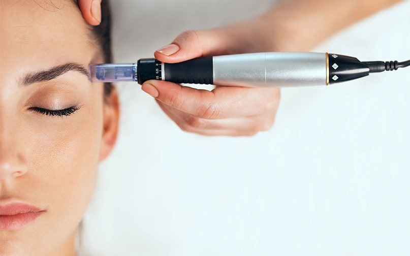 chemical peel or microneedling