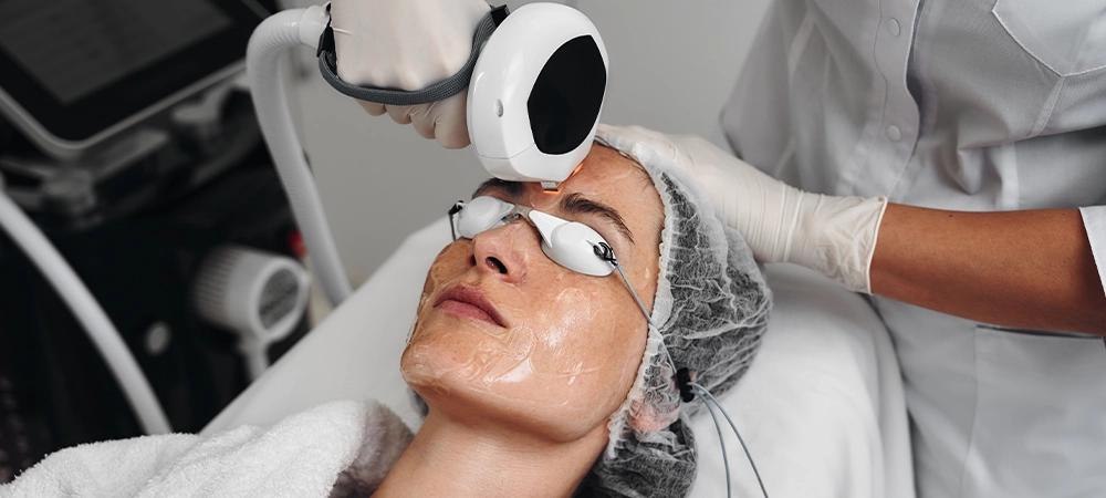 ipl laser treatment cost