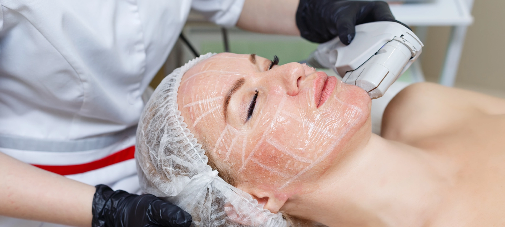 what is non-surgical facelift
