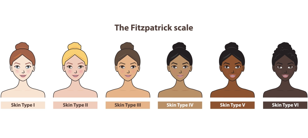 fitzpatrick scale skin type