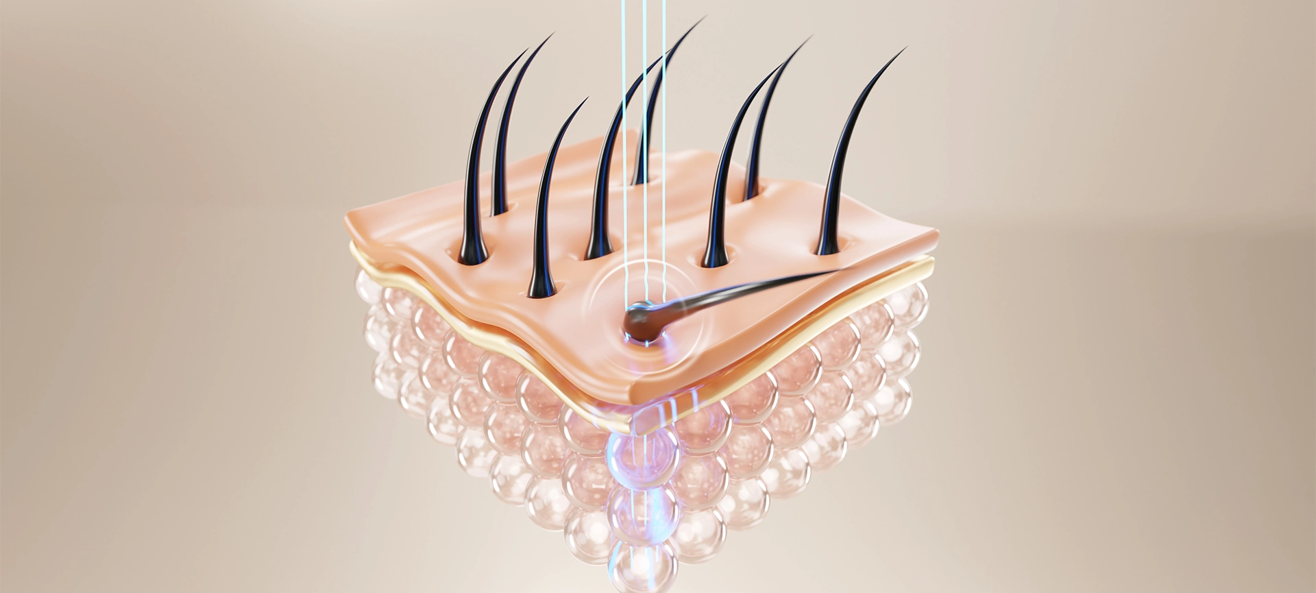 hair fall out after laser